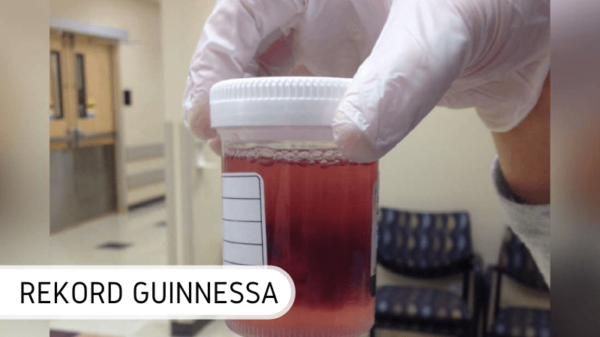 największe migdałki rekord Guinnessa